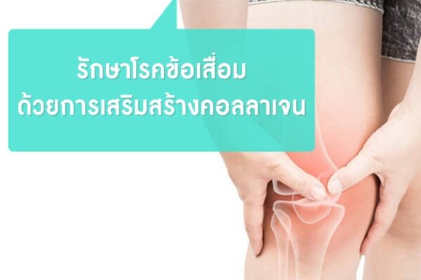 รักษาโรคข้อเสื่อม-ด้วยการเสริมสร้างคอลลา รักษาโรคข้อเสื่อม-ด้วยการเสริมสร้างคอลลา