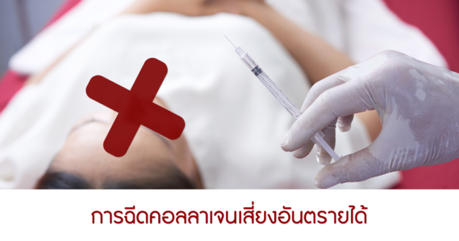 การฉีดคอลลาเจนเสี่ยงอันตรายได้
